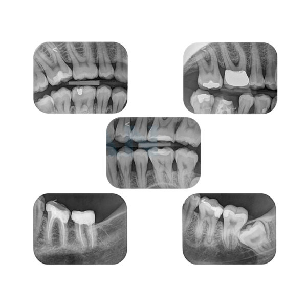 FireCR Dental Reader Lector de radiografías digitales en placas de fósforo Digiray - Imagen 2